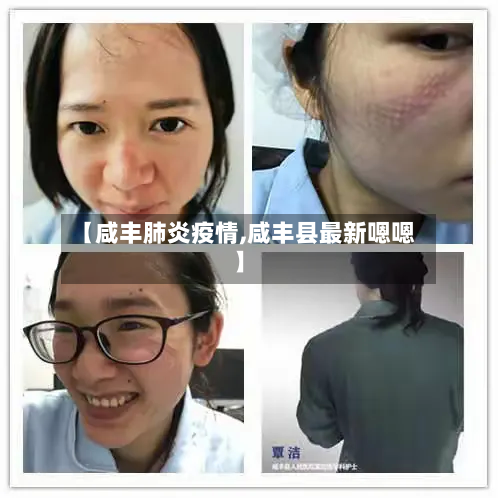 【咸丰肺炎疫情,咸丰县最新嗯嗯】-第2张图片
